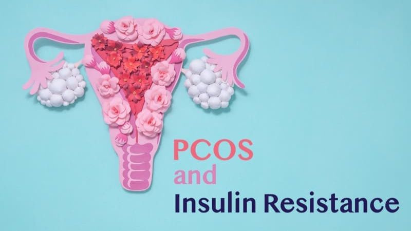 Why PCOS and Sugar Are So Closely Linked: The Insulin Resistance Connection