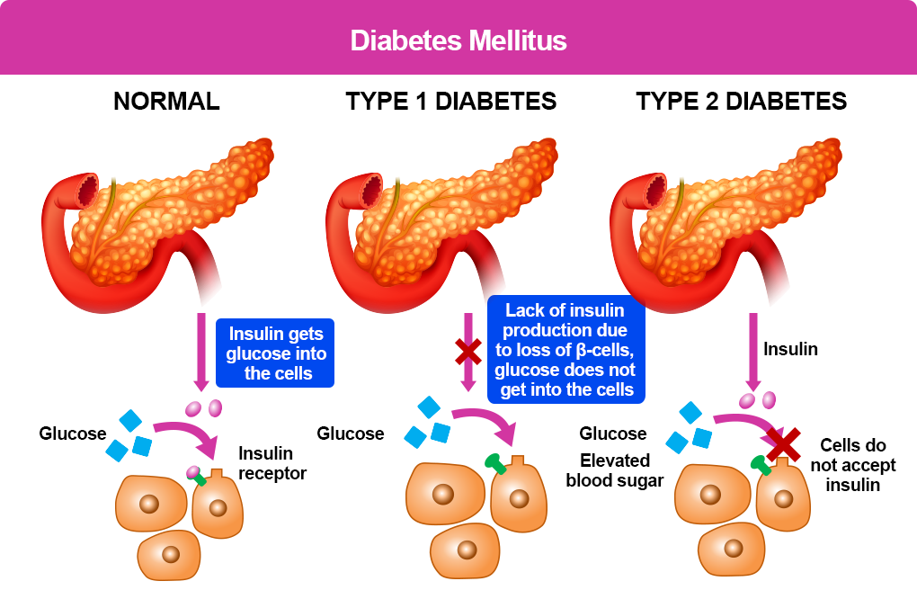 10 Warning Signs of Diabetes in Kids: What Parents Should Never Ignore