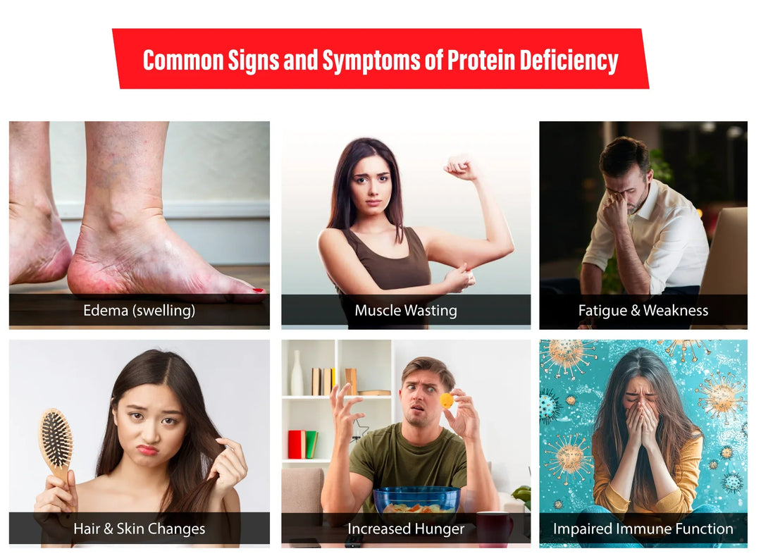 Signs and Symptoms of Protein Deficiency in the Body