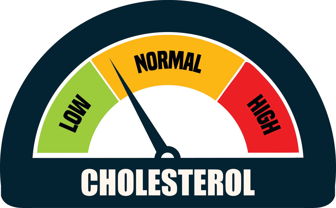 Is 250 cholesterol too high?